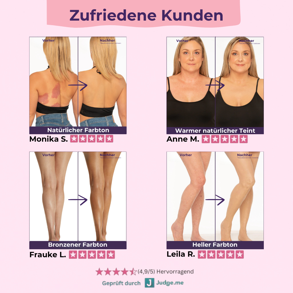 SilkCover™ Creme inkl. VitaBrush (Gratis)